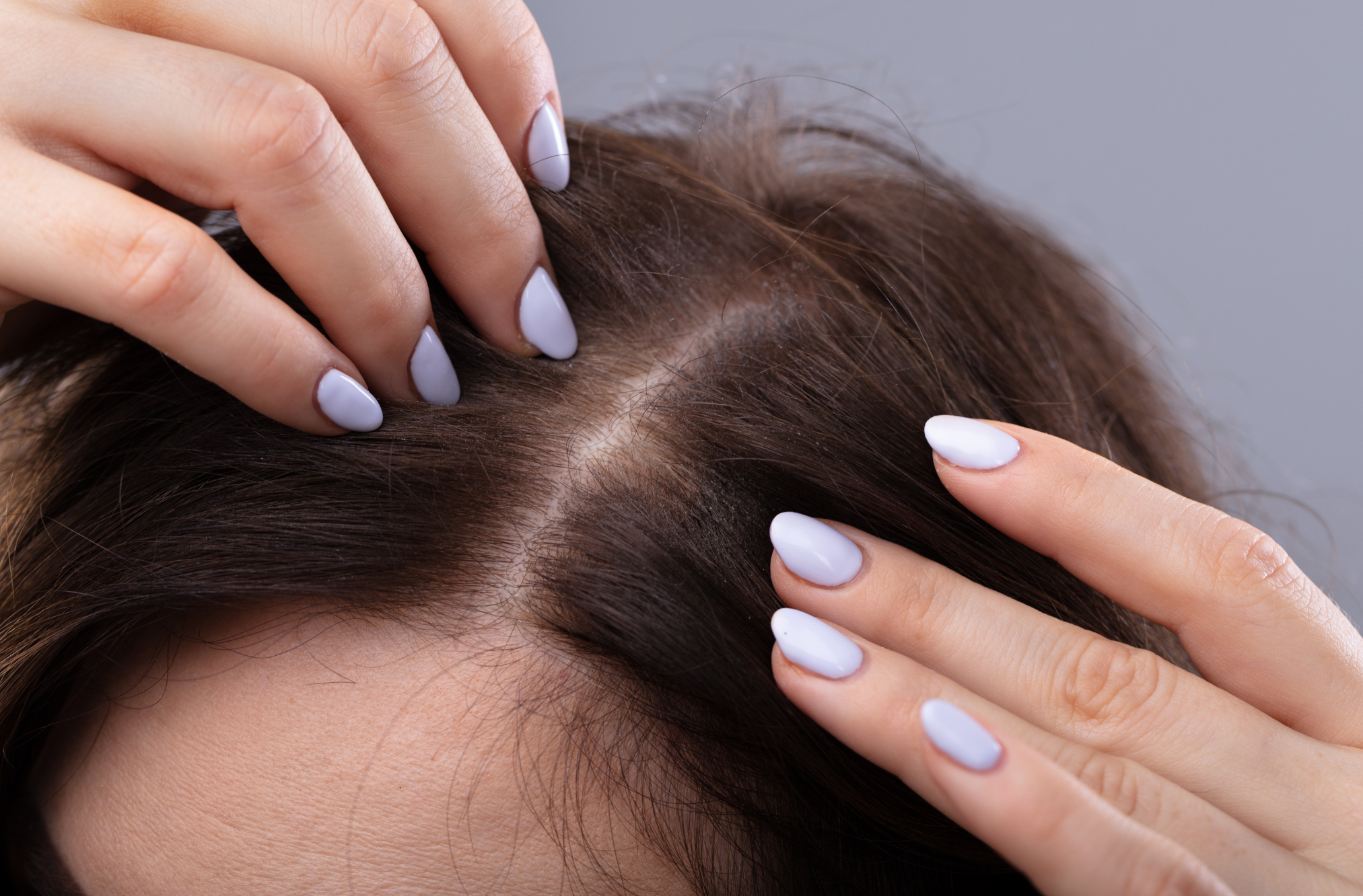 Te contamos por que tu cabello no crece foto cuero cabelludo